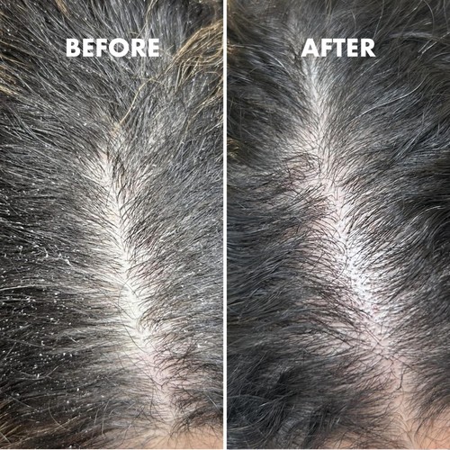 Umberto Giannini Scalp Restore Kit