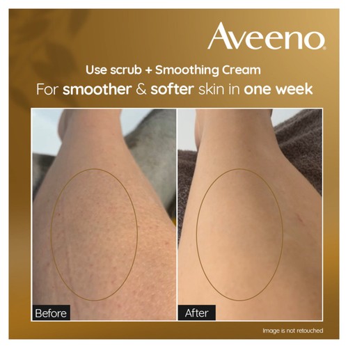 Aveeno Skin Renewal Gentle Body Scrub for Radiant Skin
