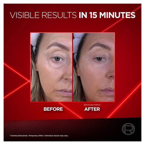 L'Oreal Paris Revitalift Laser Eye Bag Eraser