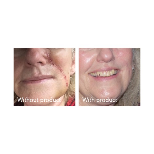 Science of Skin Solution for Scars