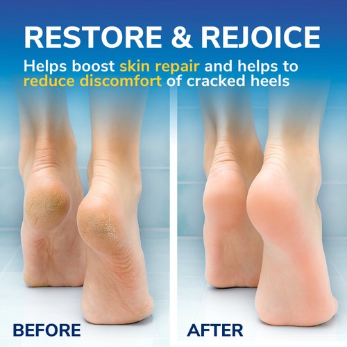 Scholl Cracked Heel Repair Cream