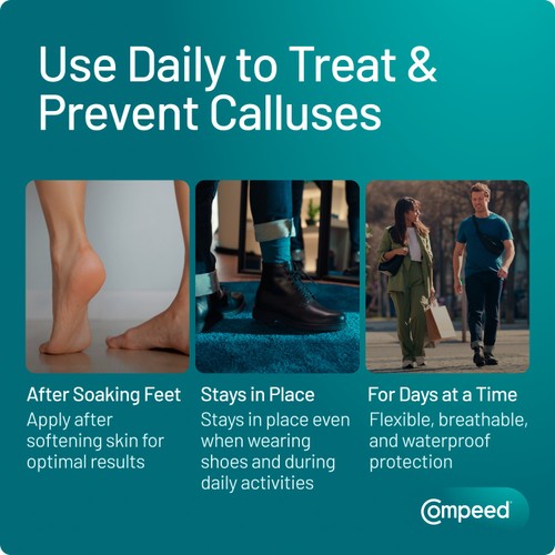 Compeed Calluses Protection Patches – 10 Hydrocolloid Units For Foot Care, Removes Calluses