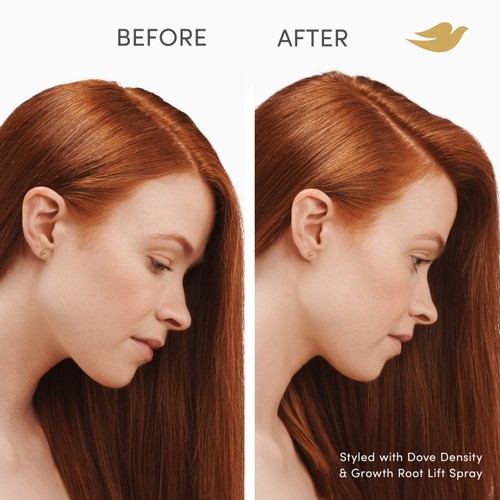 Dove Density + Hair Growth Root Lift  for Thicker, Fuller Hair