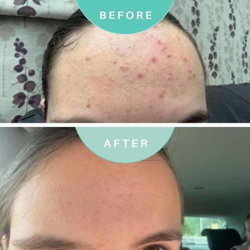 Skin Genius Best Cleanse Forever Cleansing Face Wash