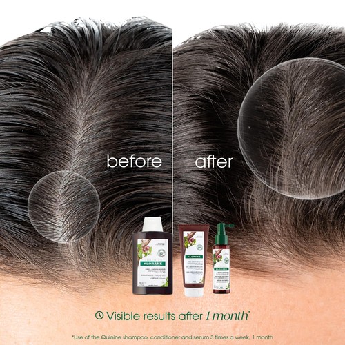 Klorane Shampoo with Quinine and Organic Edelweiss for Thinning Hair
