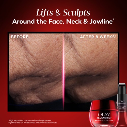 Olay Regenerist Face & Neck Treatment