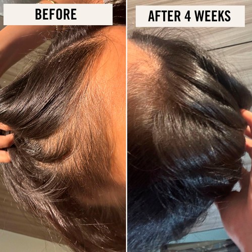 UpCircle Scalp + Hair Oil with Bacuri Butter and Castor Oil