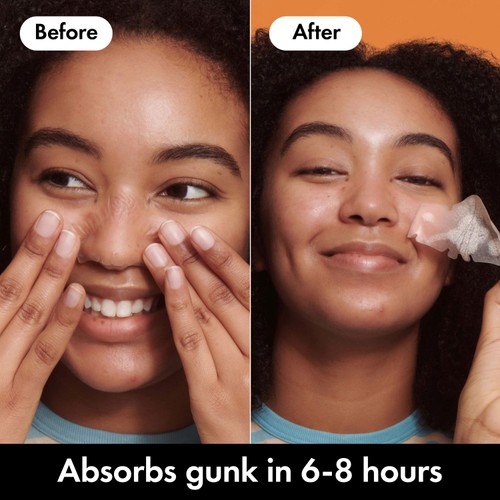 Hero Mighty Patch Nose Spot Patches, 10 Hydrocolloid Acne Patches