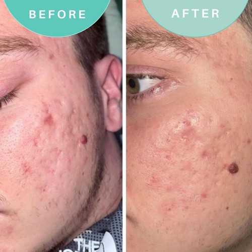 Skin Genius Soothe Operator Soothing Moisturiser