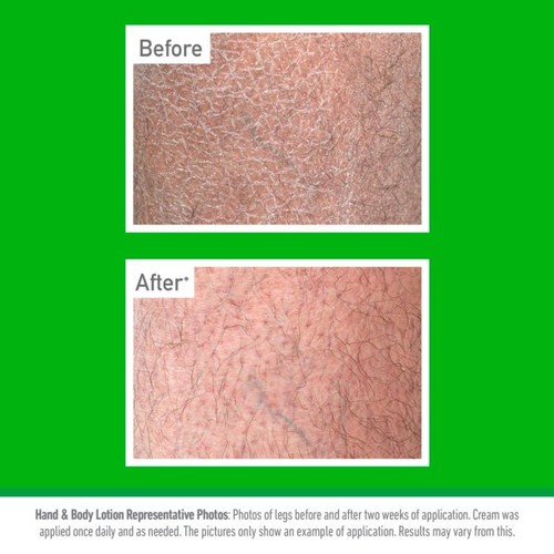 O'Keeffe's Working Hands Hand and Body Lotion