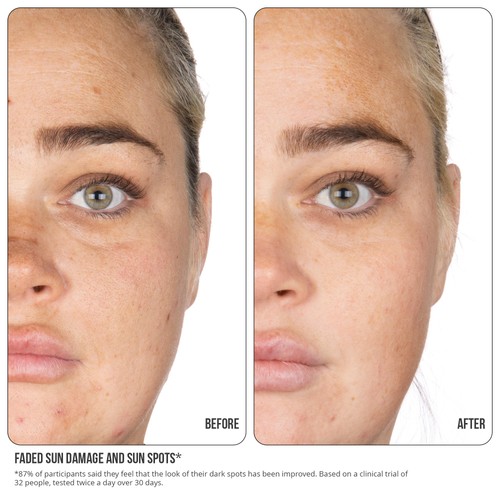Nip+Fab Vitamin C Fix Concentrate Extreme 15%
