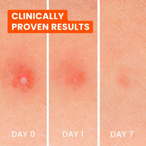 Biore Spot Control 3-in-1 Spot Patches
