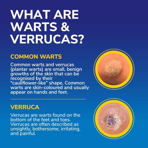 Dr Scholl's Wart & Verruca FreezeAway Max