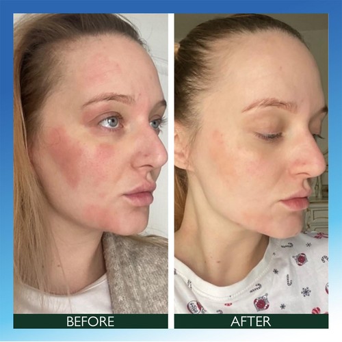 Sorted Skin Intensive Rescue Face Lotion- Microbiome Prebiotic Based