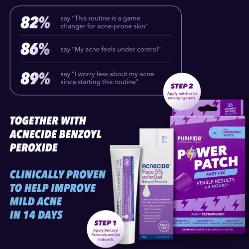 Acnecide Spot Treatment with Benzoyl Peroxide