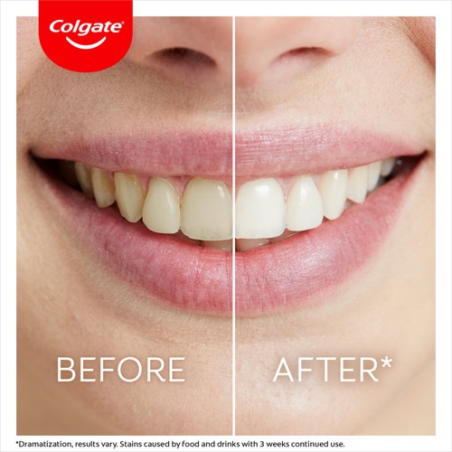 Colgate Max White Whiten At Home Teeth Whitening Pen 