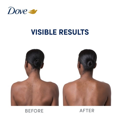 Dove Niacinimide Body Serum