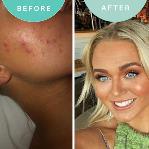 Skin Genius Soothe Operator Soothing Moisturiser