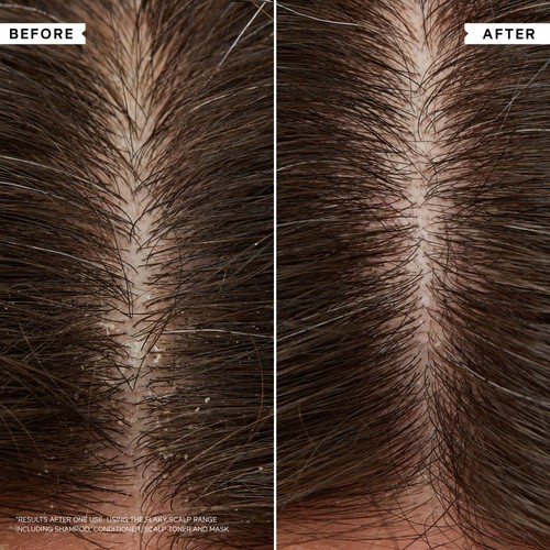 Philip Kingsley Flaky Itchy Scalp Curl Shampoo