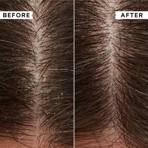 Philip Kingsley Flaky/Itchy Scalp Shampoo