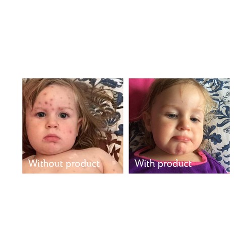 Science of Skin Solution for Scars