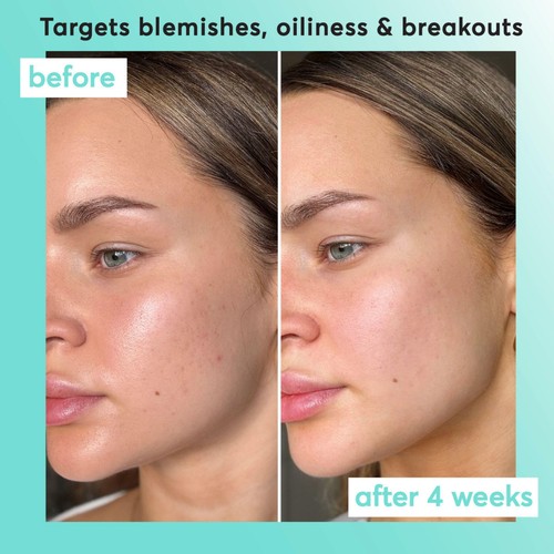 Super Facialist Clear Skin On The Spot Clarifying Gel