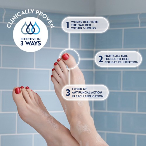 Curanail 5% Fungal Nail Treatment