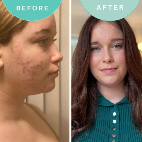 Skin Genius Best Cleanse Forever Cleansing Face Wash