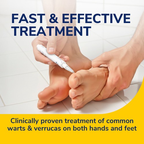 Scholl Wart & Verruca Removal Pen