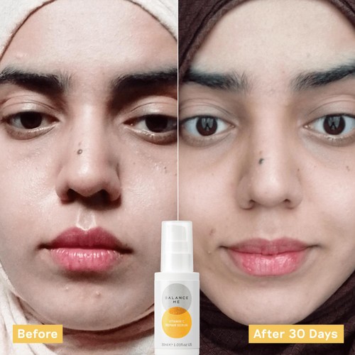 Balance Me Vitamin C Repair Serum