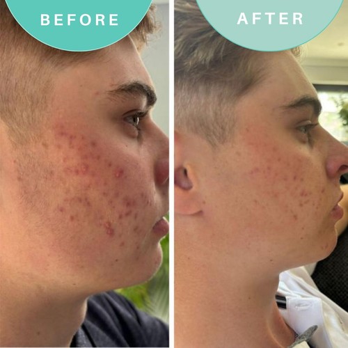 Skin Genius Alls Well That Gels Well Leave-On Purifying Gel