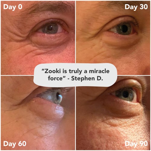 Zooki Super Strength Marine Collagen 11,000mg, Sour Cherry Sachets