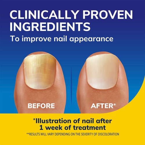 Dr Scholl's Nail Revitaliser Serum