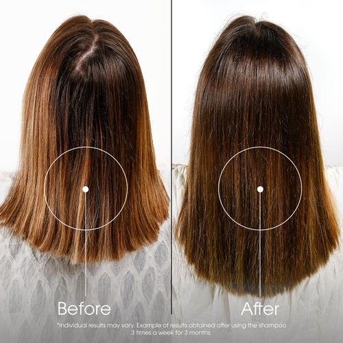 Klorane Shampoo with Quinine and Organic Edelweiss for Thinning Hair