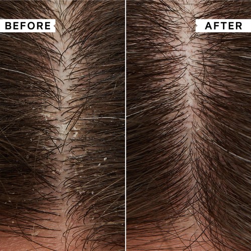Philip Kingsley Flaky Itchy Scalp Shampoo