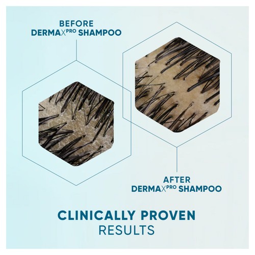 Head & Shoulder Derma X Pro Revitalise Shampoo