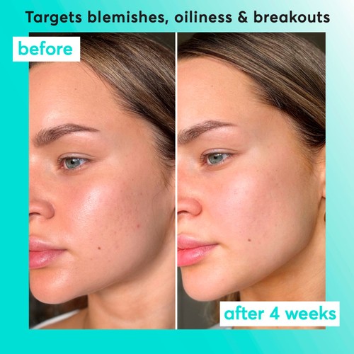 Super Facialist Clear Skin Breakout Buster Serum