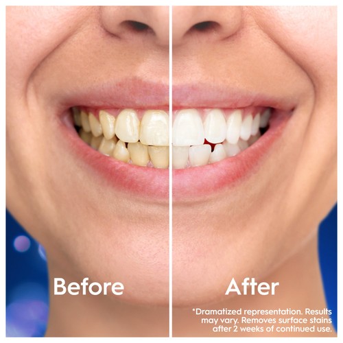 Oral-B 3D White Clinical Intensive Whitening Bright Brilliance