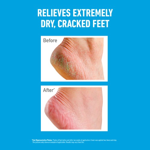 O'Keeffe's Healthy Feet Jar