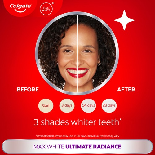 Colgate Max White Ultimate Radiance At Home Teeth Whitening Toothpaste